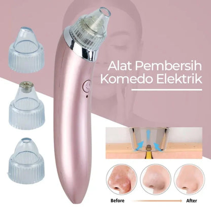 Blackhead Remover Facial Cleaner